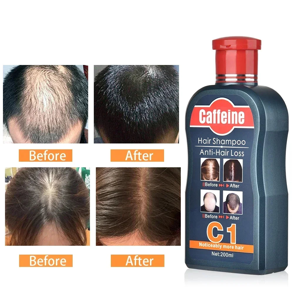 Shampoo Anticaída de Cafeína Natural para Hombre 200 ml